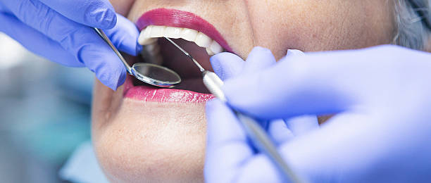 Best Dentist for Tooth Abscess  in Edgewood, OH